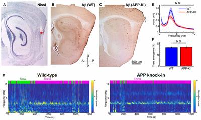 Impaired In Vivo Gamma Oscillations in the Medial Entorhinal Cortex of Knock-in Alzheimer Model